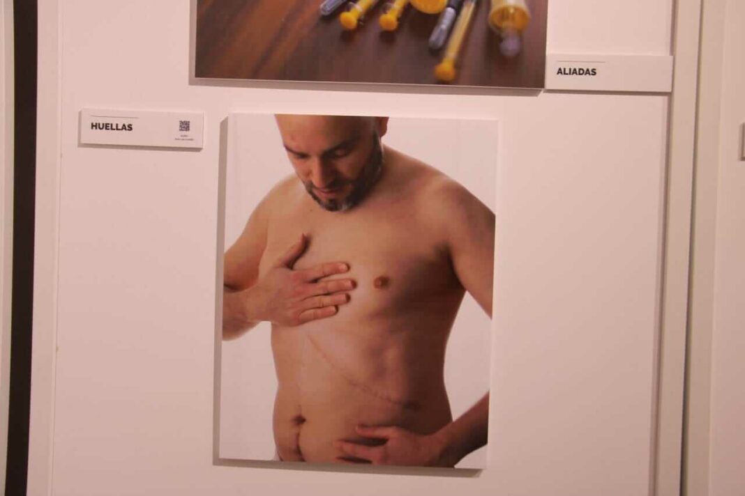 Rostros e historias frente al cáncer protagonizan una exposición abierta en Yecla